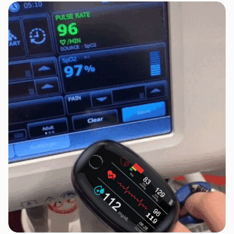 🔥Flash Sale🔥 50K Sold 🔥 Non-Invasive Blood Glucose Meter